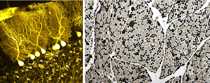 Hersen- (links) and spiercellen (rechts) (Wikipedia: BrainsRusDC, links and Nephron, rechts).